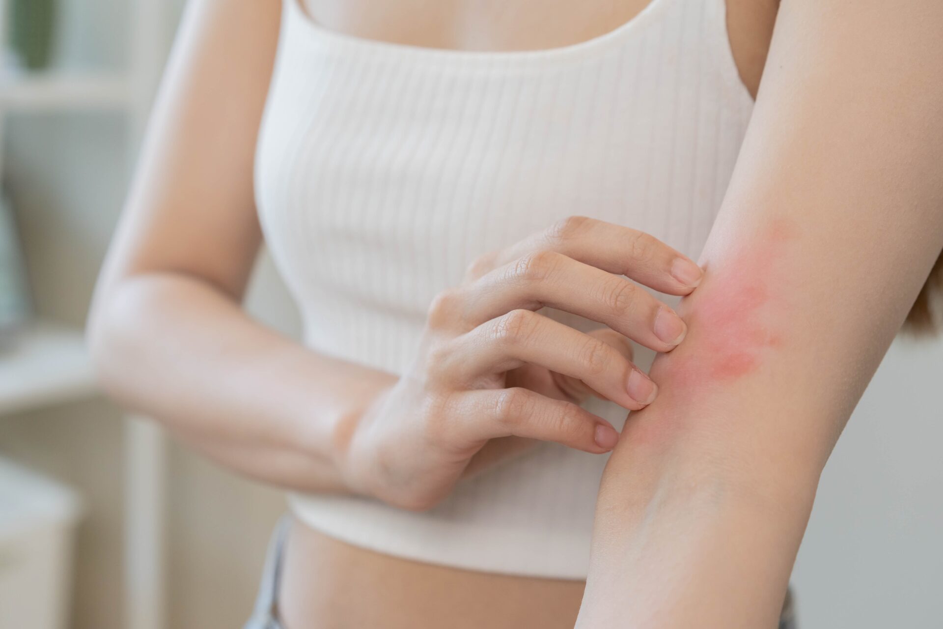 Dermatitis is a term used for different types of skin inflammation, typically characterized by itchiness, redness and a rash. In cases of short duration, there may be small blisters, while in long-term cases the skin may become thickened. The area of skin involved can vary from small to covering the entire body.